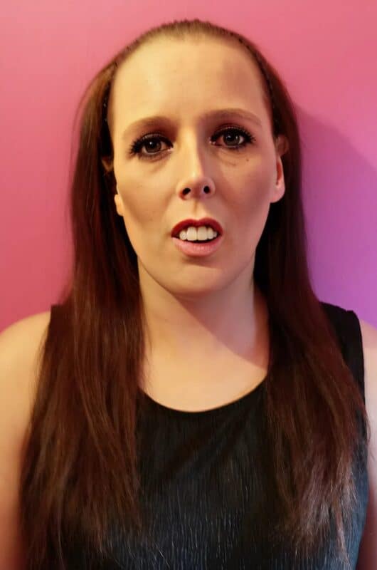 Эта девушка стала знаменитой благодаря своей необычной внешности: вы не поверите, как она выглядит сейчас, после стоматологической операции 