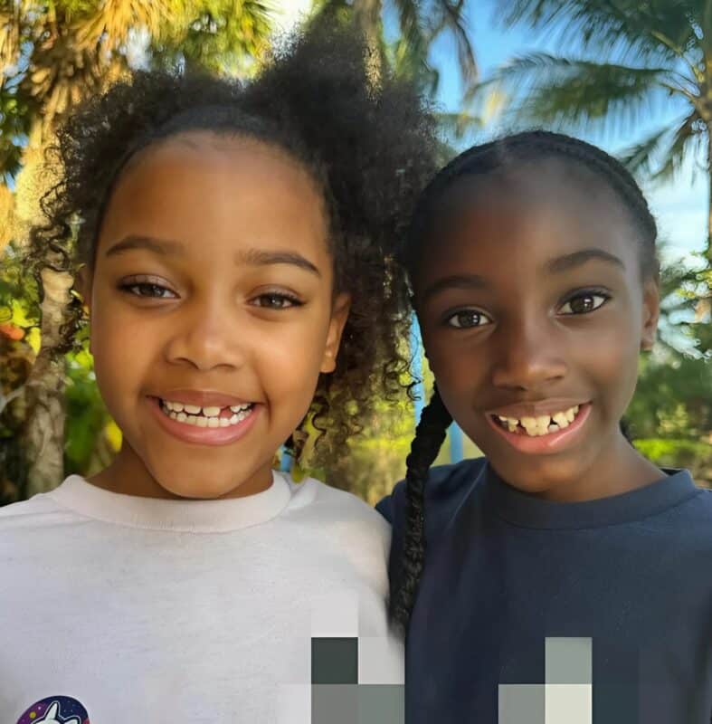 Сестры-близнецы родились с разным цветом кожи с разницей всего несколько минут: вот как они выглядят спустя 9 лет