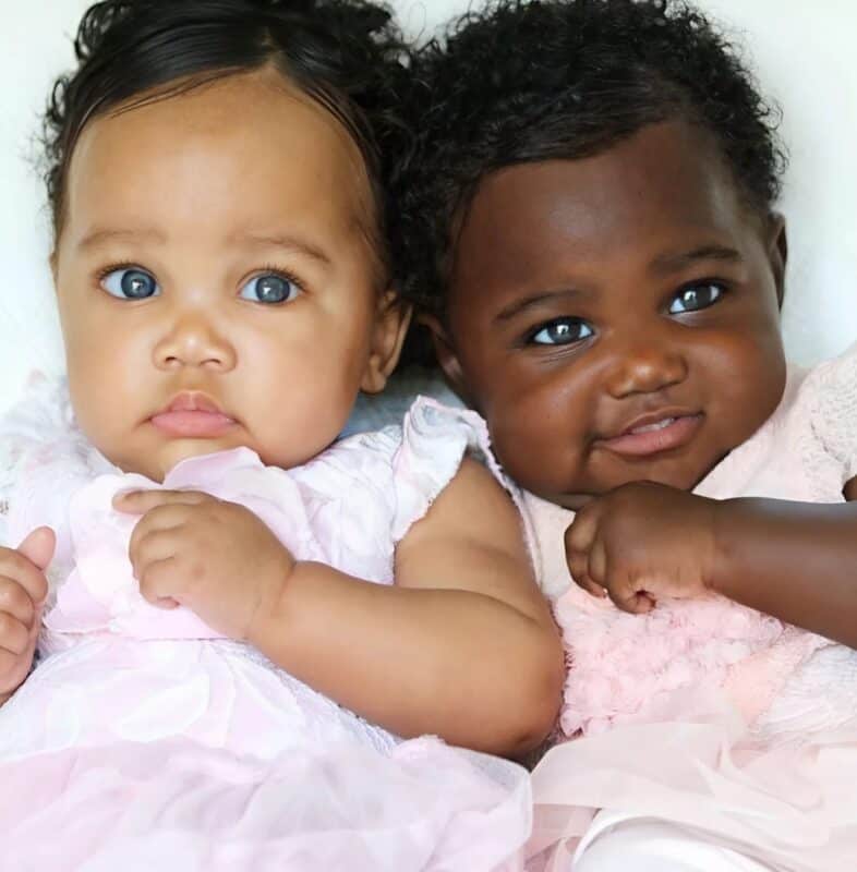 Сестры-близнецы родились с разным цветом кожи с разницей всего несколько минут: вот как они выглядят спустя 9 лет